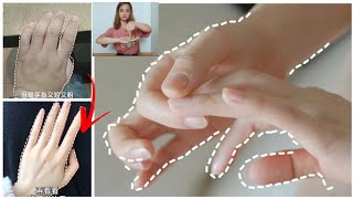 exercises for fingers  elongate and slim fingers ♥️for beautiful hands [upl. by Nahtnaoj]