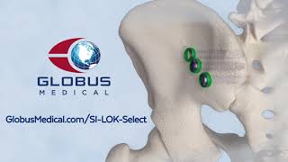 SILOK® SELECT Sacroiliac Joint Fusion System [upl. by Gargan]