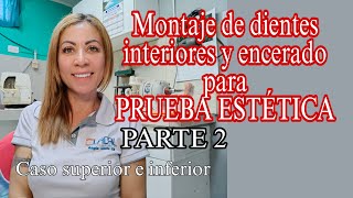 Montaje de dientes inferiores y encerado para PRUEBA ESTETICA PROTESIS FLEXIBLES caso supinf [upl. by Fatima]