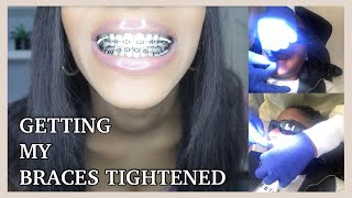 Getting My Braces TIGHTENED For The First Time  How To Prepare Yourself and What To Expect [upl. by Lenoyl]