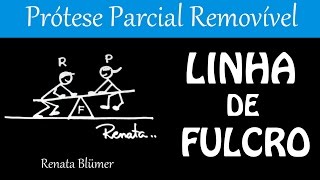 PPR PLANEJAMENTO  LINHA DE FULCRO  ALAVANCA [upl. by Lerrej]