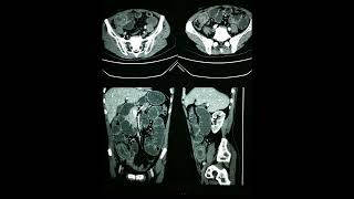 RADIOLOGY EXAM CASES [upl. by Ramyaj]