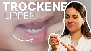 Tipps zur Lippenpflege  Warum Lippen austrocknen  Dr med Alice Martin👄 [upl. by Anadal]