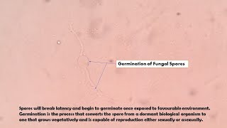 Germination of Fungal Spores Demonstration [upl. by Fechter]