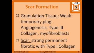 Complement System Granulomas Exudate Granulation Tissue C5a multinucleated giant cells [upl. by Atirec]