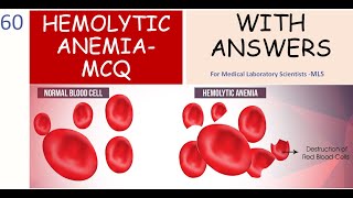 Hemolytic Anemia Review  MCQs With Answers [upl. by Lleuqram664]