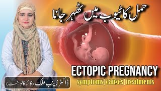 What is Ectopic pregnancy  Risk factorssymptoms and Treatment of Ectopic Pregnancy by Dr Zainab [upl. by Fairfield330]