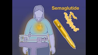 Semaglutide and Cardiovascular Outcomes in Obesity  NEJM [upl. by Nahtanha936]