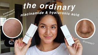 the ordinary niacinamide and hyaluronic acid 1 MONTH review with BEFOREAFTER [upl. by Langbehn909]