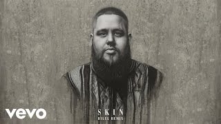 RagnBone Man  Skin Bilel Remix Audio [upl. by Macrae289]