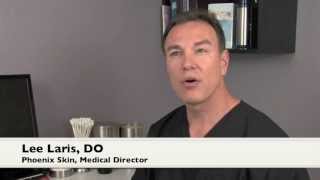 Male Genital Wart Symptoms Explained By Phoenix Cosmetic Surgeon [upl. by Nuhs68]