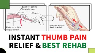 De quervain’s tenosynovitis exercises by Mr Physio wrist thumb pain relief [upl. by Aihsenak]