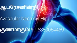 Avn Treatment without Surgery tamil  Madurai Avoid Total Hip Replacement Surgery avntamil [upl. by Aiello]