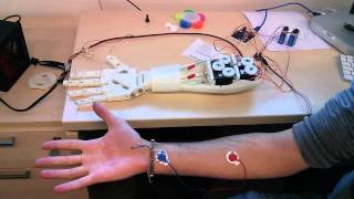 Roujin Project  InMoov Arm and EMG 1 [upl. by Mesics]