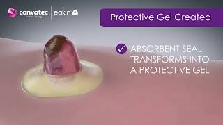 Less ostomy leaks with eakin Cohesive® Seals [upl. by Ecirehc]