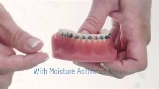 OrthoDots MoistureActivated quotWaxquot Covers for Dental Braces [upl. by Akima317]