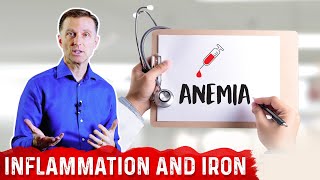 Why Chronic Inflammation Causes Anemia Iron Deficiency – Anemia of Chronic Disease – DrBerg [upl. by Eniamaj]