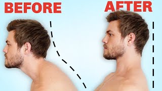 How to Fix Forward Head Posture FOREVER [upl. by Felicdad]