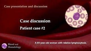 Patient case discussion case 2 [upl. by Ruthanne]