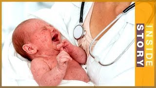 Why is measles back and spreading l Inside Story [upl. by Calabrese]