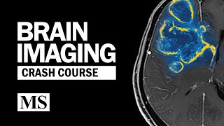 Brain Imaging Crash Course [upl. by Kulsrud]