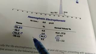 HbE disease question solving [upl. by Gilbertson]