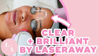 Why You Need Clear  Brilliant Watch this Treatment in Action [upl. by Adalbert]