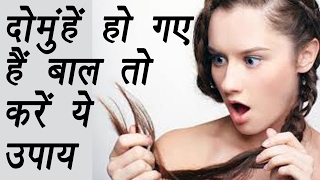 How to treat Split hairs end  Home Remedies  दोमुंहें हैं बाल तो करें ये उपाय  Boldsky [upl. by Esilanna]