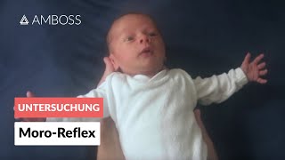 MoroReflex  Frühkindliche Reflexe  AMBOSS Video [upl. by Ocisnarf629]