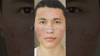 Zuniga on Natural Face Mask Glow Up in 7 Days [upl. by Auqinaj]