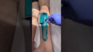 Professional lower leg wax using blue hard wax from Starpil hairremoval waxingexpert [upl. by Einned949]