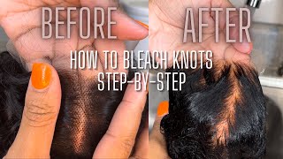 HOW TO BLEACH KNOTS ON LACE CLOSURE  DETAILED STEPBYSTEP [upl. by Holms127]