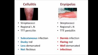 cellulitis vs erysipelas [upl. by Elbon]