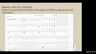 Mount Sinai Kravis Childrens Hospital Pediatric EP Conference 102620 [upl. by Myrlene]