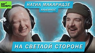 АЛЬБИНОС НАТИА МАКАРИДЗЕ  НА СВЕТЛОЙ СТОРОНЕ [upl. by Aiem]