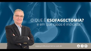 Esofagectomia o que é e casos indicados  Prof Dr Luiz Carneiro CRM 22761 [upl. by Yatnuahs]