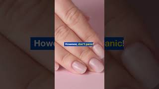 5Second Finger Test for Lung Cancer Detection lungcancer healthtips diamondtester [upl. by Scevor]