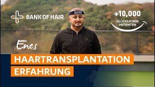 Enes Haartransplantation Erfahrung  BANK OF HAIR [upl. by Ssidnac]