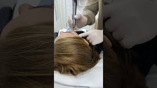 Say goodbye to unwanted moles with laser mole removal shortvideo moleremovaltreatment [upl. by Inahet131]