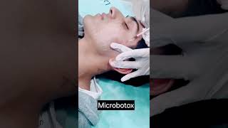 Microbotox for treating open pores oily skin at Myra skin and hair solutions Delhi microbotox [upl. by Alegnatal]