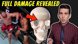 Jiri Prochazka Elbow FULL DAMAGE vs Dominick Reyes  Doctor Explains UFC Injury [upl. by Ginnifer]