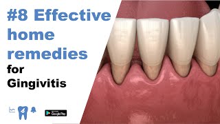 8 Effective home remedies for gingivitis [upl. by Ytnom646]