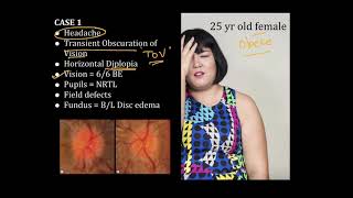 High Yield Topic  Papilledema  A Complete Review [upl. by Newel]