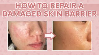 How to Heal a Damaged Skin Barrier 101  Tips to Repair a Damaged Moisture Barrier [upl. by Bard]