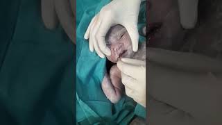 Baby mukesscusction just after birth immediately 1s tstep mouth 2nd steps nosebabycare nicubaby [upl. by Sira21]