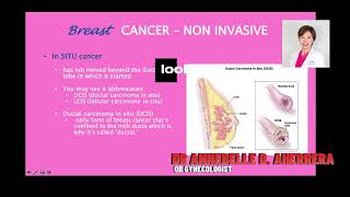 DUCTAL CARCINOMA IN SITU [upl. by Seka252]