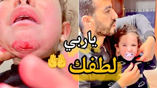 فاجعة وقعت لينا لبنتي سجى😫بنتي غير ربي اللطف بيها😢اللهم اجرني في مصيبتي يارب🤲 [upl. by Ahsiea]