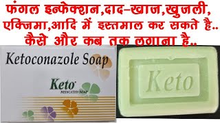 Keto Soap UsesBenefits Side Effects  Ketoconazole 2 ww Soap🔥🔥 [upl. by Schaumberger]