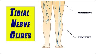 Flossing Exercises for TIBIAL NERVE ENTRAPMENT and TARSAL TUNNEL SYNDROME [upl. by Melva]