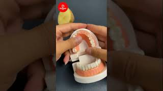 Fix your chipped or broken teeth at home easy  DIY TOOTH BONDING  Life Hacks Box [upl. by Anwahsar]